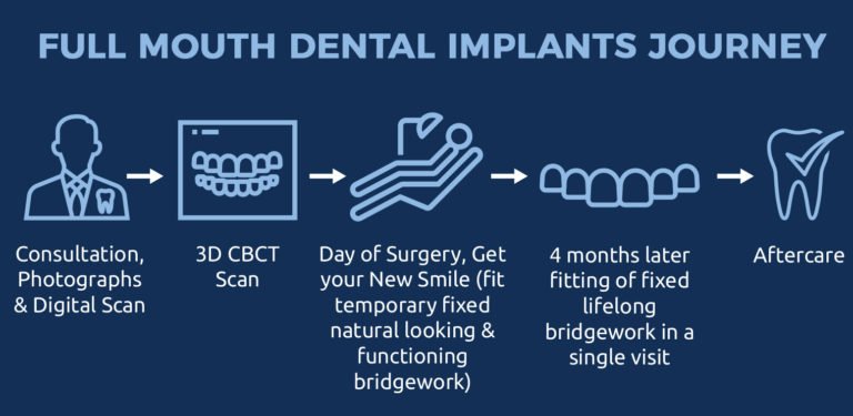 Infinity Implants Infinityblu Dental Implants - The Confidence to Smile Again