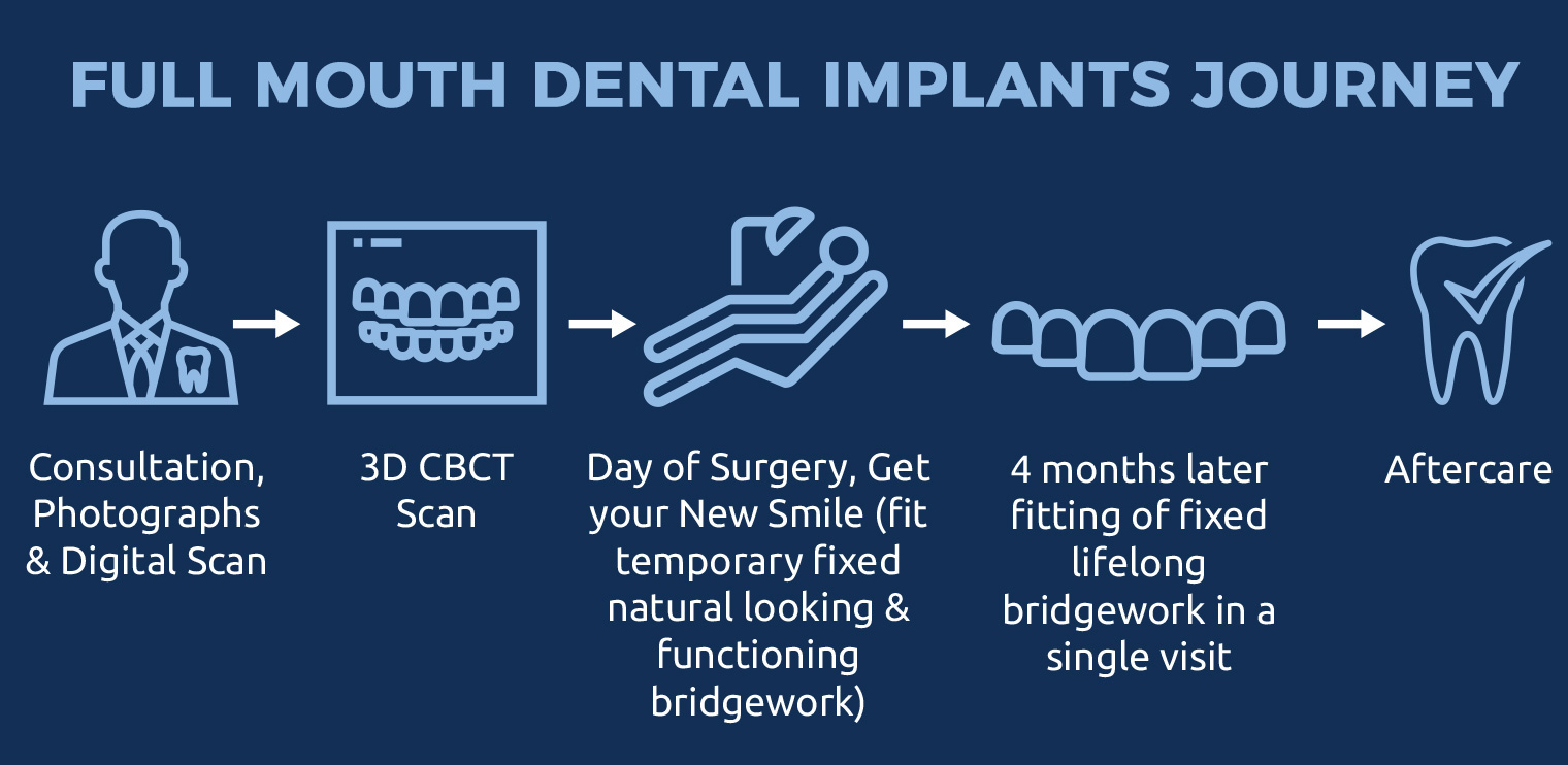 Full Mouth Dental Implants Journey